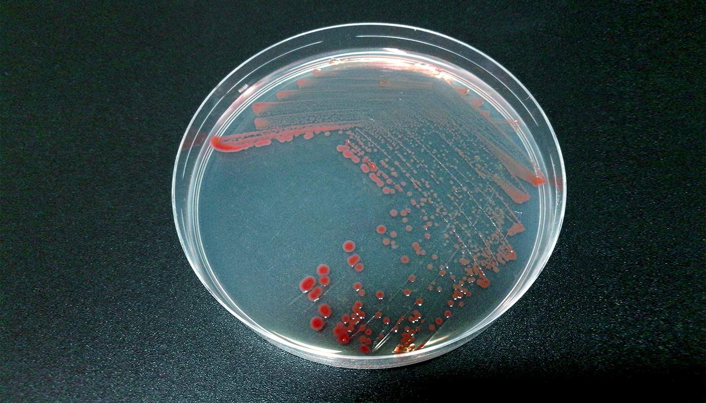 玫瑰桿菌（<em>Roseobacter </em>）