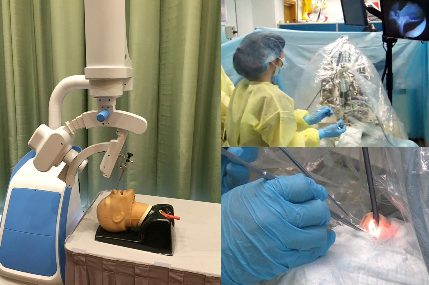 One surgery robot helps with nasal surgery by maneuvering an endoscope mechanically