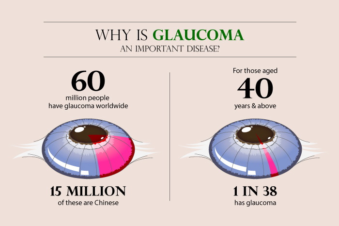 Why is glaucoma an important disease?