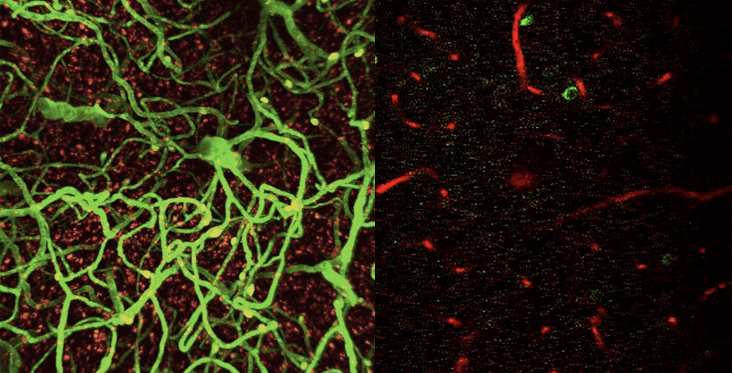 Through analysing blood-brain barrier integrity (left), neurovascular coupling (right) and performing in vivo functional interrogations, Professor Ko finds out that diabetic drugs could be useful in reversing age-related deterioration