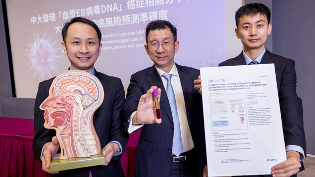 CUHK finds molecular features associated with nasopharyngeal cancer, enabling precise risk stratification