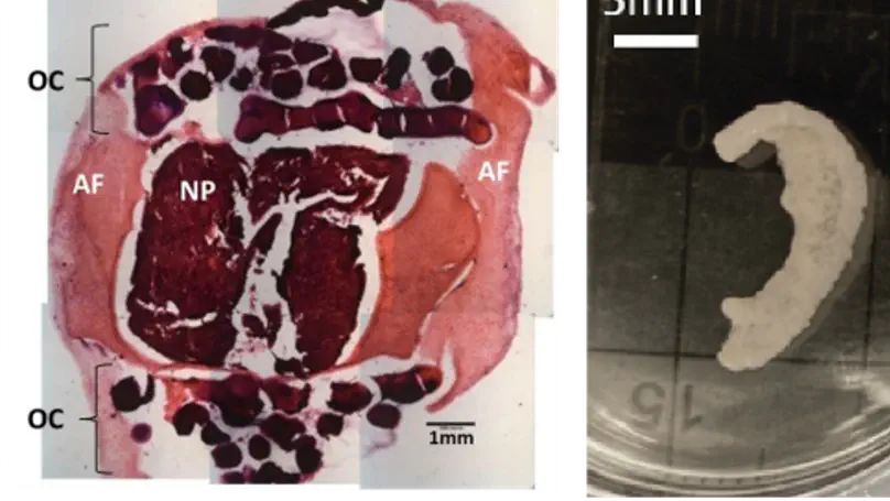 Tissue Engineering and Regenerative Medicine