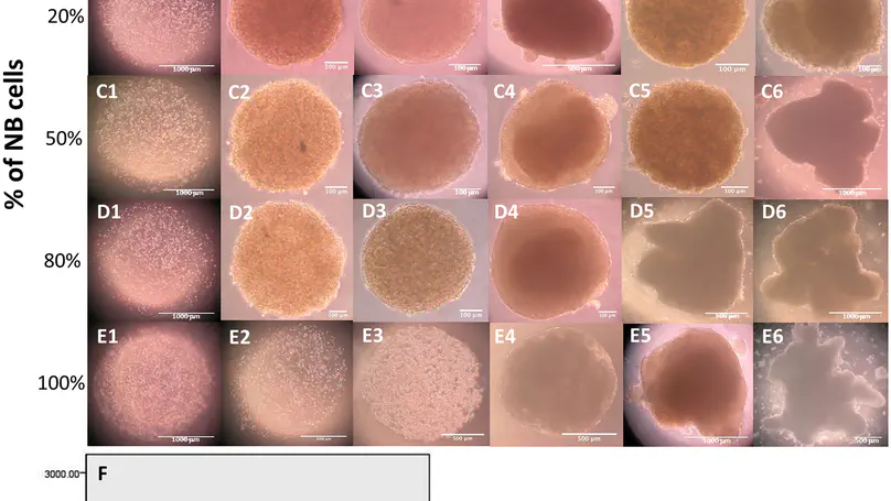 Microencapsulation of Neuroblastoma Cells and Mesenchymal Stromal Cells in Collagen Microspheres: A 3D Model for Cancer Cell Niche Study